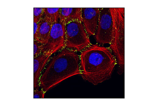 Immunofluorescence Image 1: P-Cadherin (C13F9) Rabbit mAb