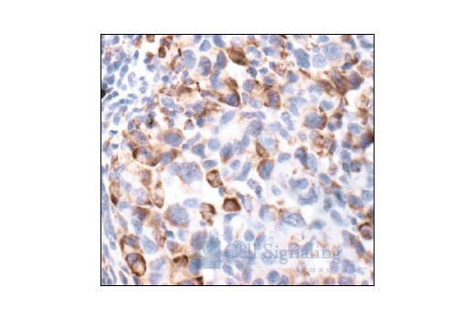 Immunohistochemistry Image 1: Phospho-S6 Ribosomal Protein (Ser235/236) Antibody