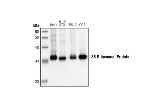 Western Blotting Image 1: S6 Ribosomal Protein (5G10) Rabbit mAb (BSA and Azide Free)