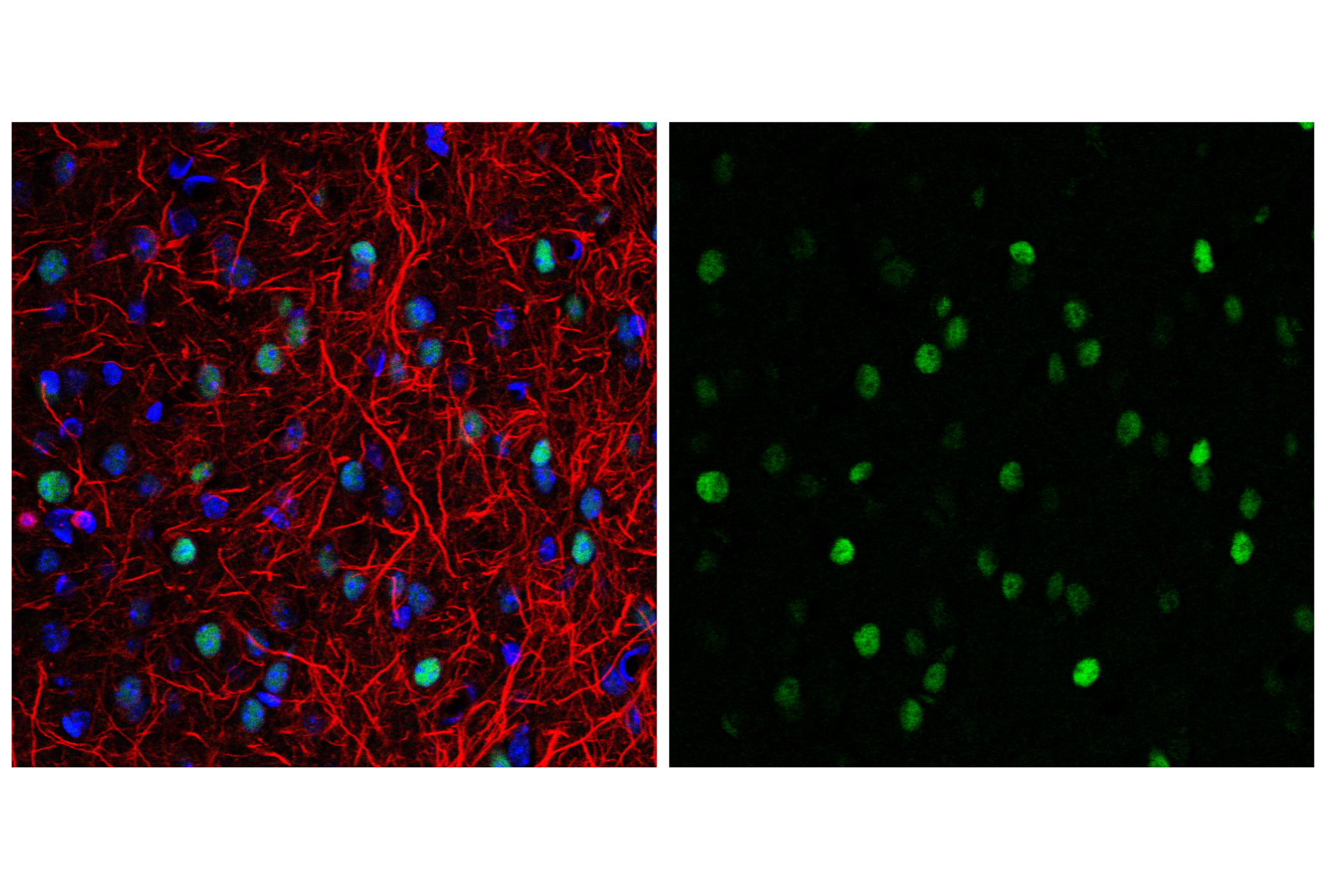 Immunofluorescence Image 1: c-Fos (9F6) Rabbit mAb