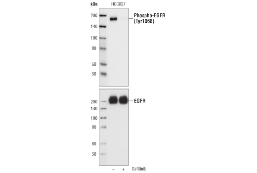 Immunoprecipitation Image 1: EGF Receptor (EGFR1) Mouse mAb