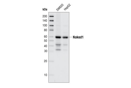  Image 3: Wnt Signaling Antibody Sampler Kit