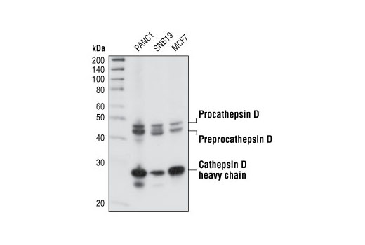 Western Blotting Image 1: Cathepsin D Antibody