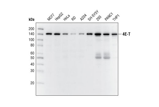 Western Blotting Image 1: 4E-T Antibody