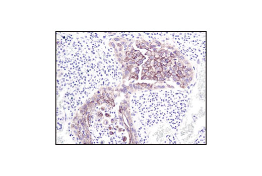 Immunohistochemistry Image 3: γ-Catenin Antibody