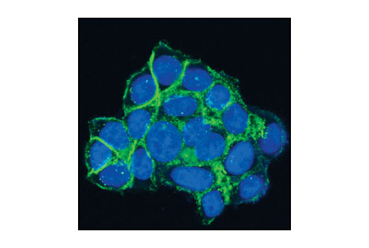 Immunofluorescence Image 1: γ-Catenin Antibody