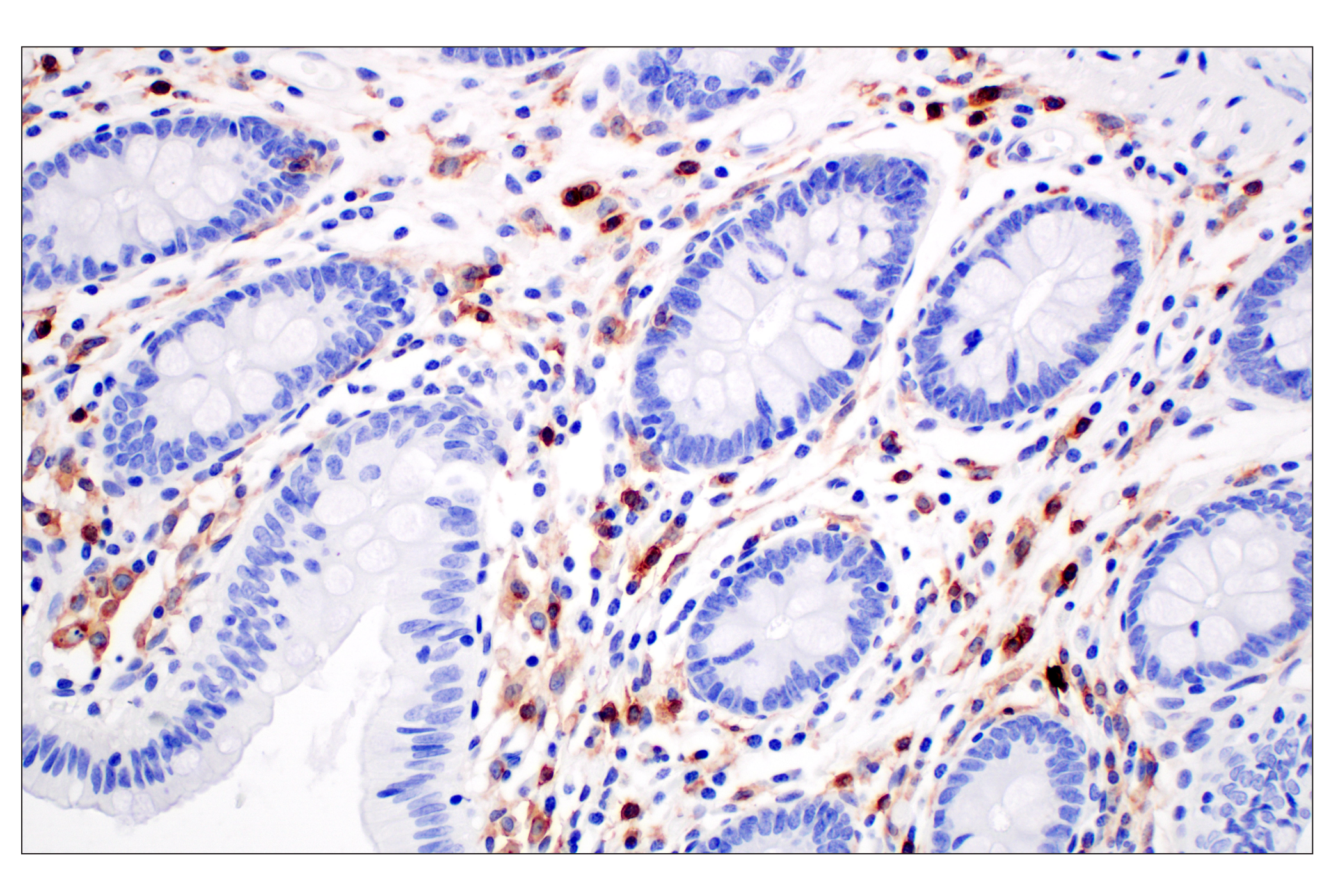 Immunohistochemistry Image 7: CD4 (MSVA-004R) Rabbit mAb (BSA and Azide Free)