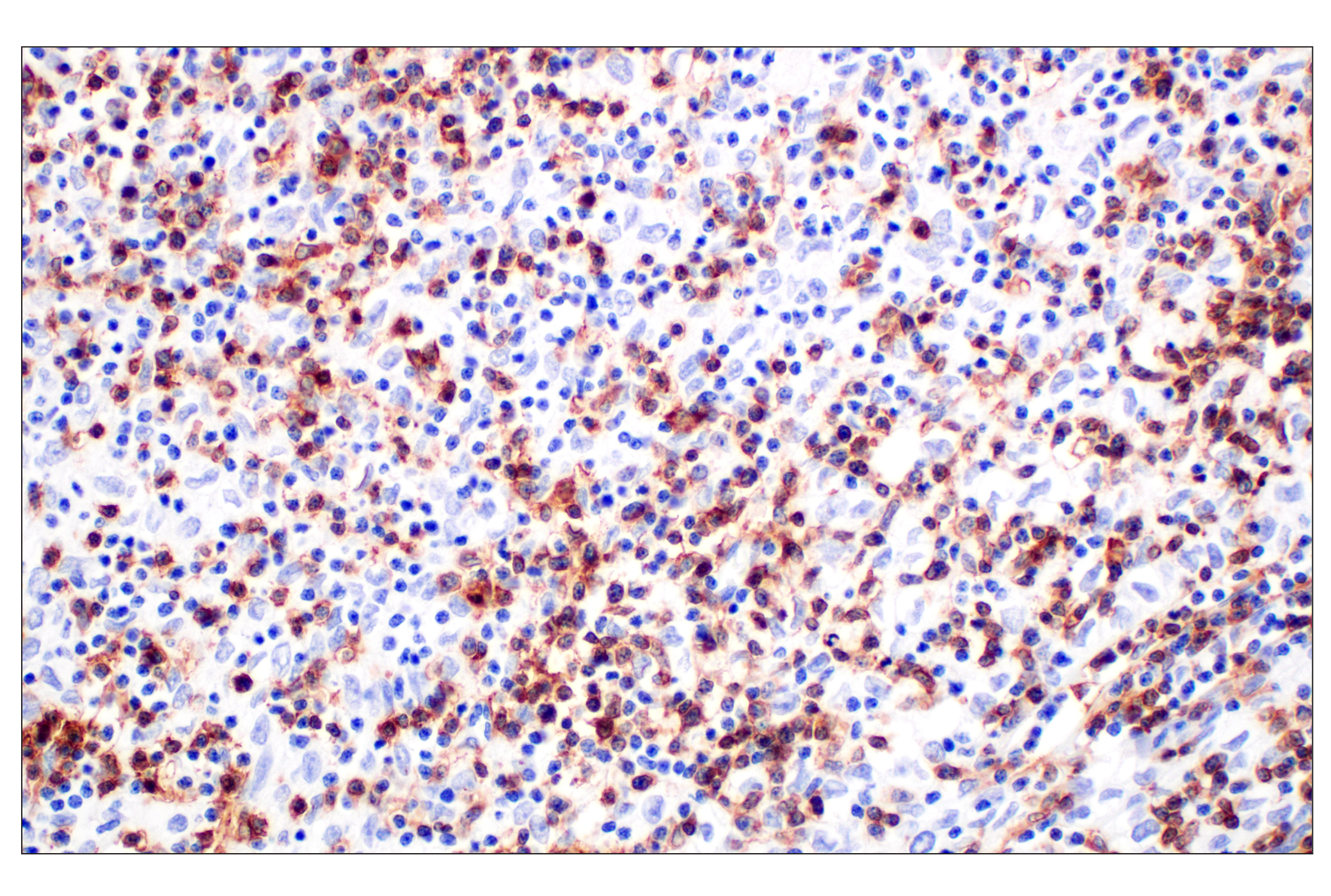 Immunohistochemistry Image 1: CD4 (MSVA-004R) Rabbit mAb (BSA and Azide Free)