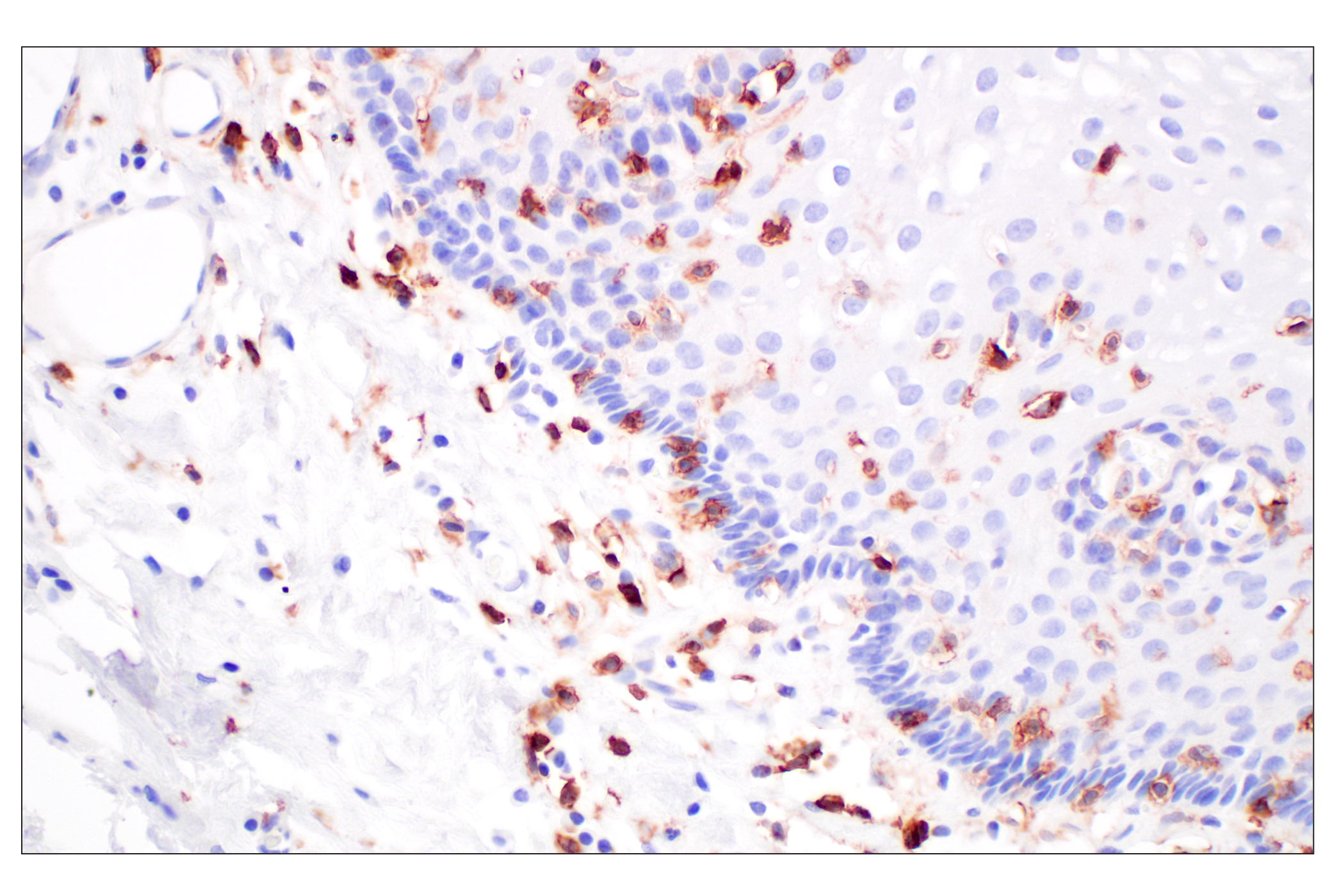 Immunohistochemistry Image 6: CD4 (MSVA-004R) Rabbit mAb (BSA and Azide Free)