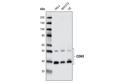  Image 8: CDK Antibody Sampler Kit