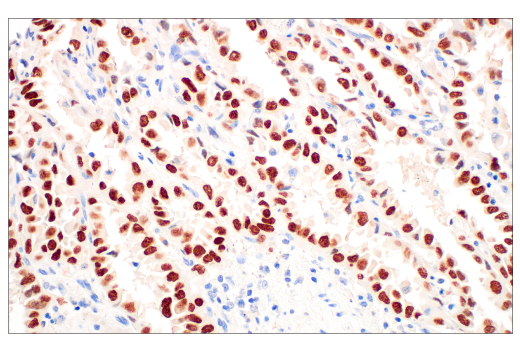 Immunohistochemistry Image 1: Thyroid Transcription Factor 1 (TTF-1) (SPT24) Mouse mAb