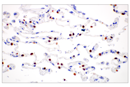 Immunohistochemistry Image 4: Thyroid Transcription Factor 1 (TTF-1) (SPT24) Mouse mAb
