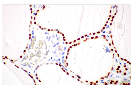 Immunohistochemistry Image 3: Thyroid Transcription Factor 1 (TTF-1) (SPT24) Mouse mAb