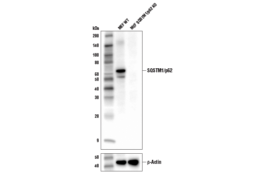  Image 2: Mouse Reactive Cell Death and Autophagy Antibody Sampler Kit