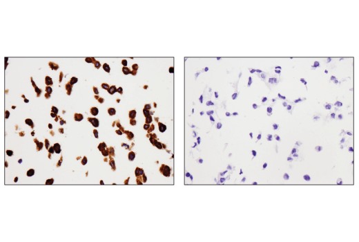  Image 34: Mouse Reactive Cell Death and Autophagy Antibody Sampler Kit