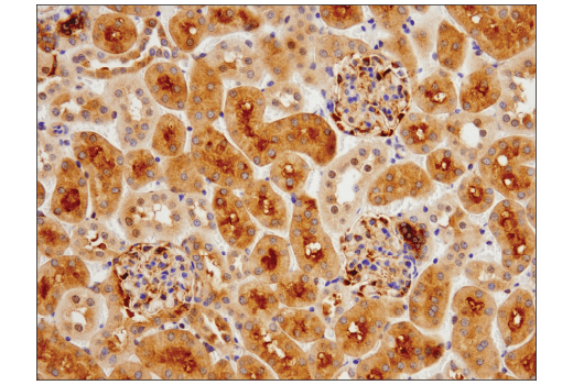  Image 43: Mouse Reactive Cell Death and Autophagy Antibody Sampler Kit