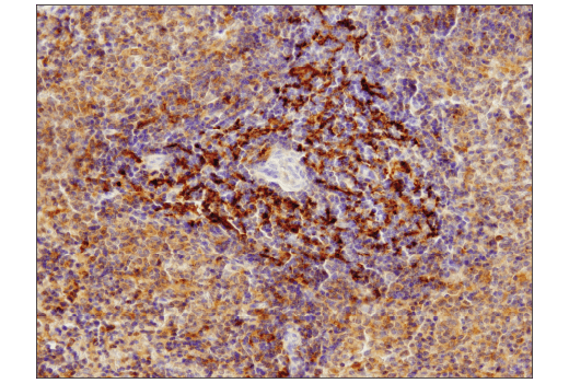  Image 49: Mouse Reactive Cell Death and Autophagy Antibody Sampler Kit