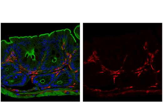Immunofluorescence Image 1: VISTA (D5L5T) XP® Rabbit mAb (Alexa Fluor® 555 Conjugate)