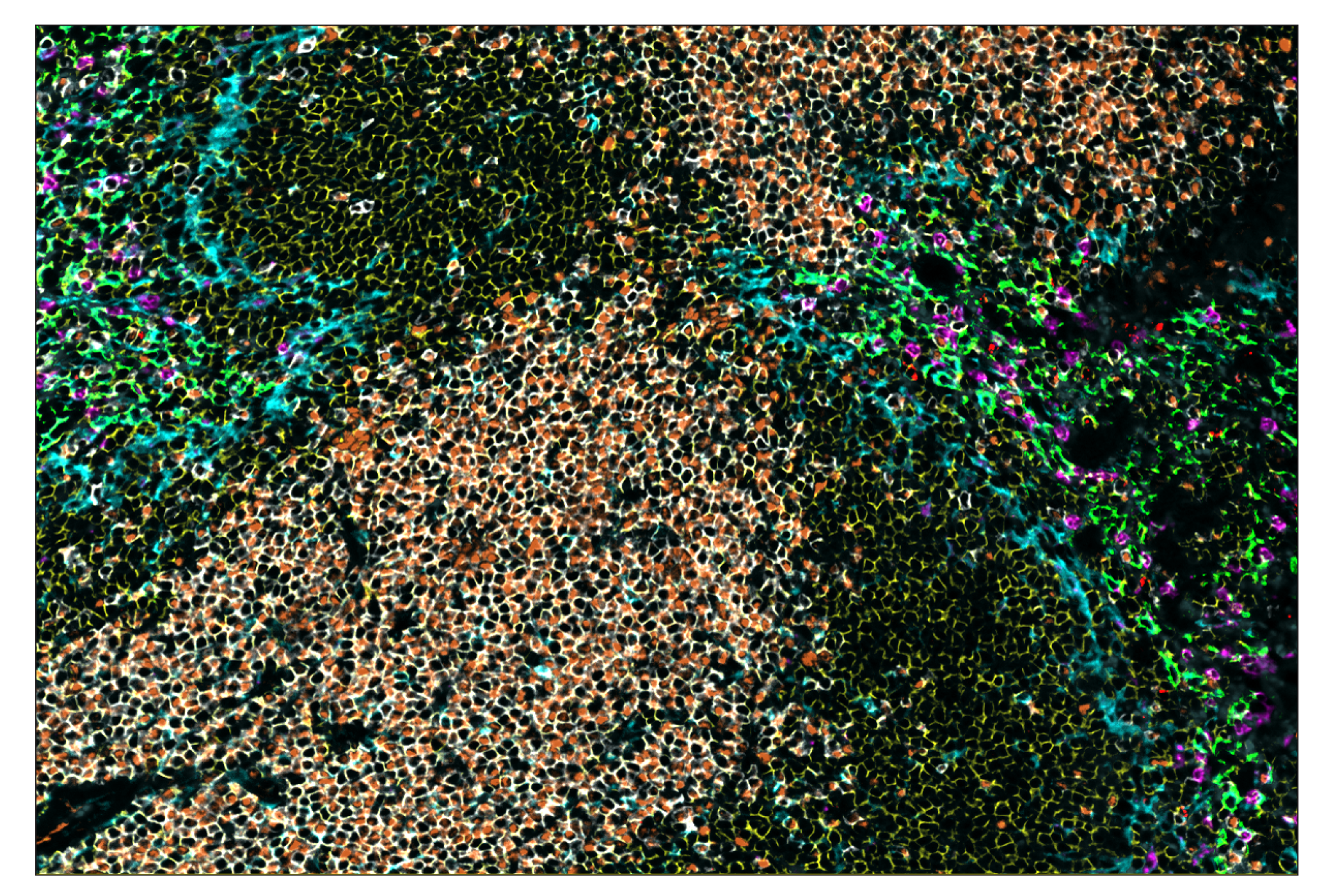 Immunohistochemistry Image 1: CD86 (E5W6H) & CO-0051-488 SignalStar™ Oligo-Antibody Pair