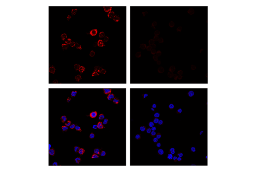 Immunofluorescence Image 1: CD68 (D4B9C) XP® Rabbit mAb (Alexa Fluor® 555 Conjugate)