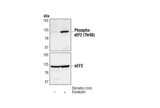 Western Blotting Image 1: Phospho-eEF2 (Thr56) Antibody
