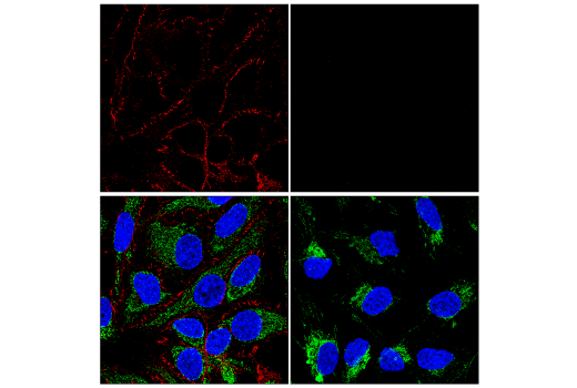 Immunofluorescence Image 2: β-Catenin (D10A8) XP® Rabbit mAb (Alexa Fluor® 647 Conjugate)