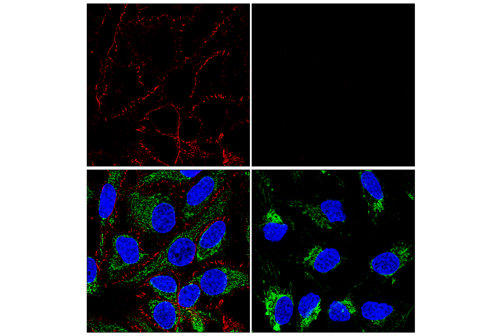 Immunofluorescence Image 2: β-Catenin (D10A8) XP® Rabbit mAb (Alexa Fluor® 647 Conjugate)