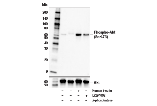 Western Blotting Image 1: Phospho-Akt (Ser473) (E4U3U) Mouse mAb