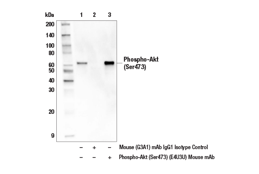 Immunoprecipitation Image 1: Phospho-Akt (Ser473) (E4U3U) Mouse mAb