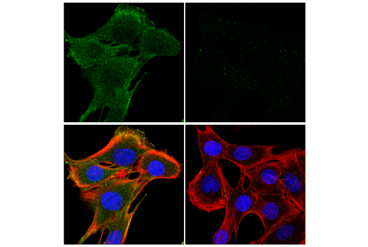 Immunofluorescence Image 1: Phospho-Akt (Ser473) (E4U3U) Mouse mAb