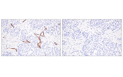  Image 42: Pancreatic Marker IHC Antibody Sampler Kit