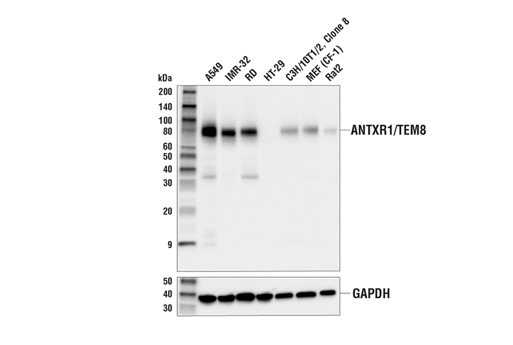 Western Blotting Image 1: ANTXR1/TEM8 Antibody