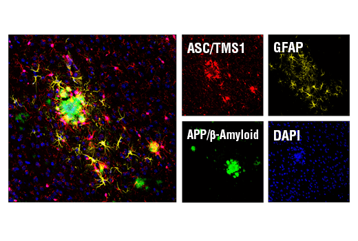 Immunofluorescence Image 1: ASC/TMS1 (D2W8U) Rabbit mAb (Alexa Fluor® 647 Conjugate)