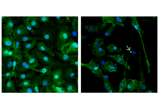 Immunofluorescence Image 2: ASC/TMS1 (D2W8U) Rabbit mAb (Alexa Fluor® 647 Conjugate)