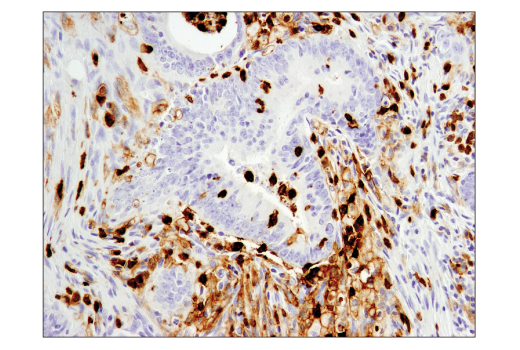 Immunohistochemistry Image 2: CD11b/ITGAM (D6X1N) Rabbit mAb (BSA and Azide Free)