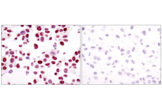 Immunohistochemistry Image 2: Androgen Receptor (D6F11) XP® Rabbit mAb (BSA and Azide Free)