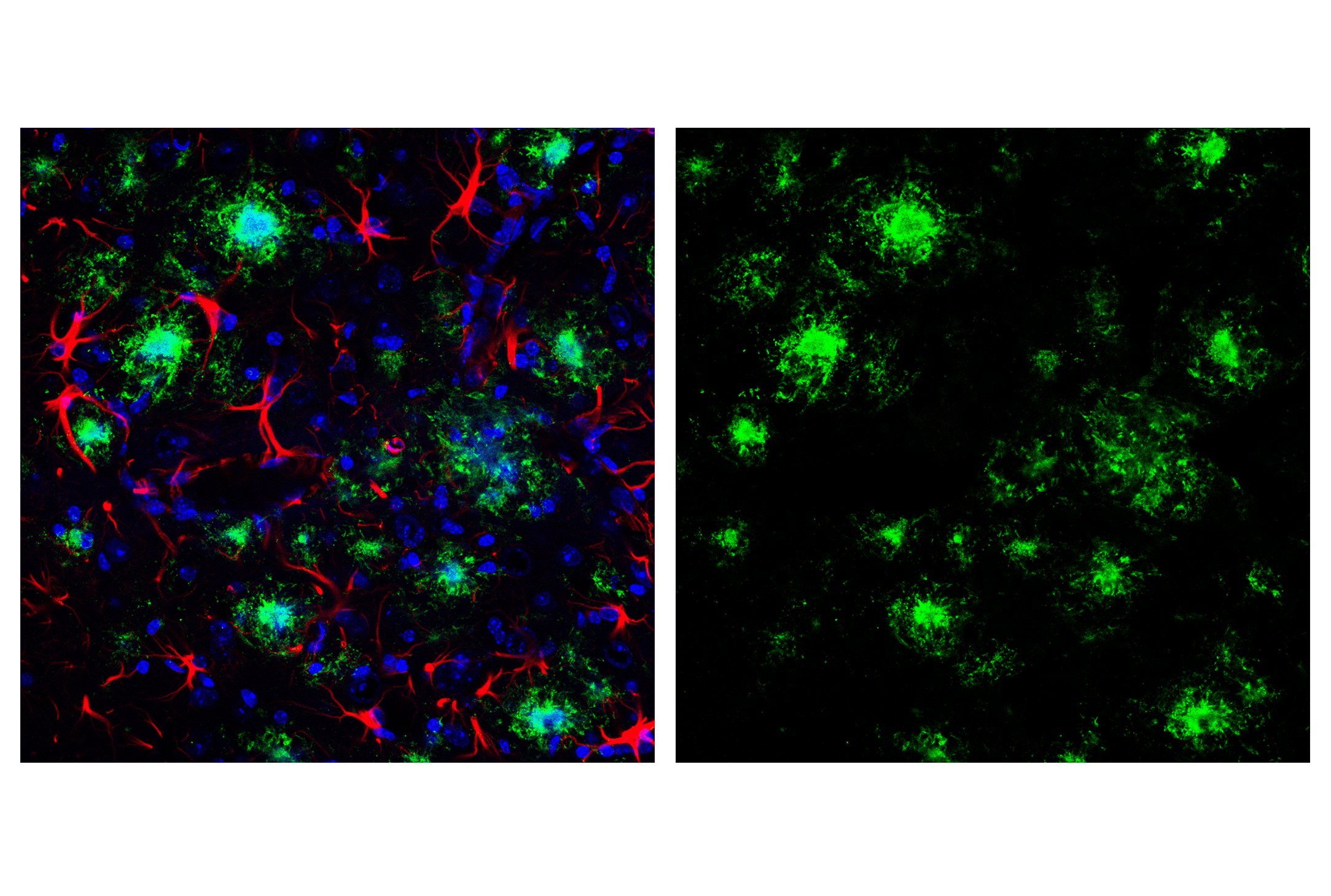 Immunofluorescence Image 1: β-Amyloid (1-42) (E6D5M) Rabbit mAb