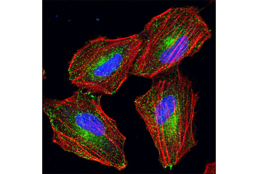 Immunofluorescence Image 1: Rab11a Antibody