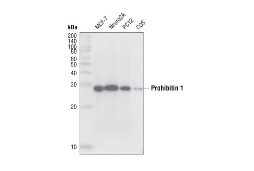 Western Blotting Image 1: PHB1 Antibody