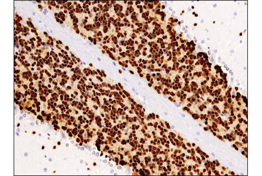  Image 11: β-Amyloid Mouse Model Neuronal Viability IF Antibody Sampler Kit
