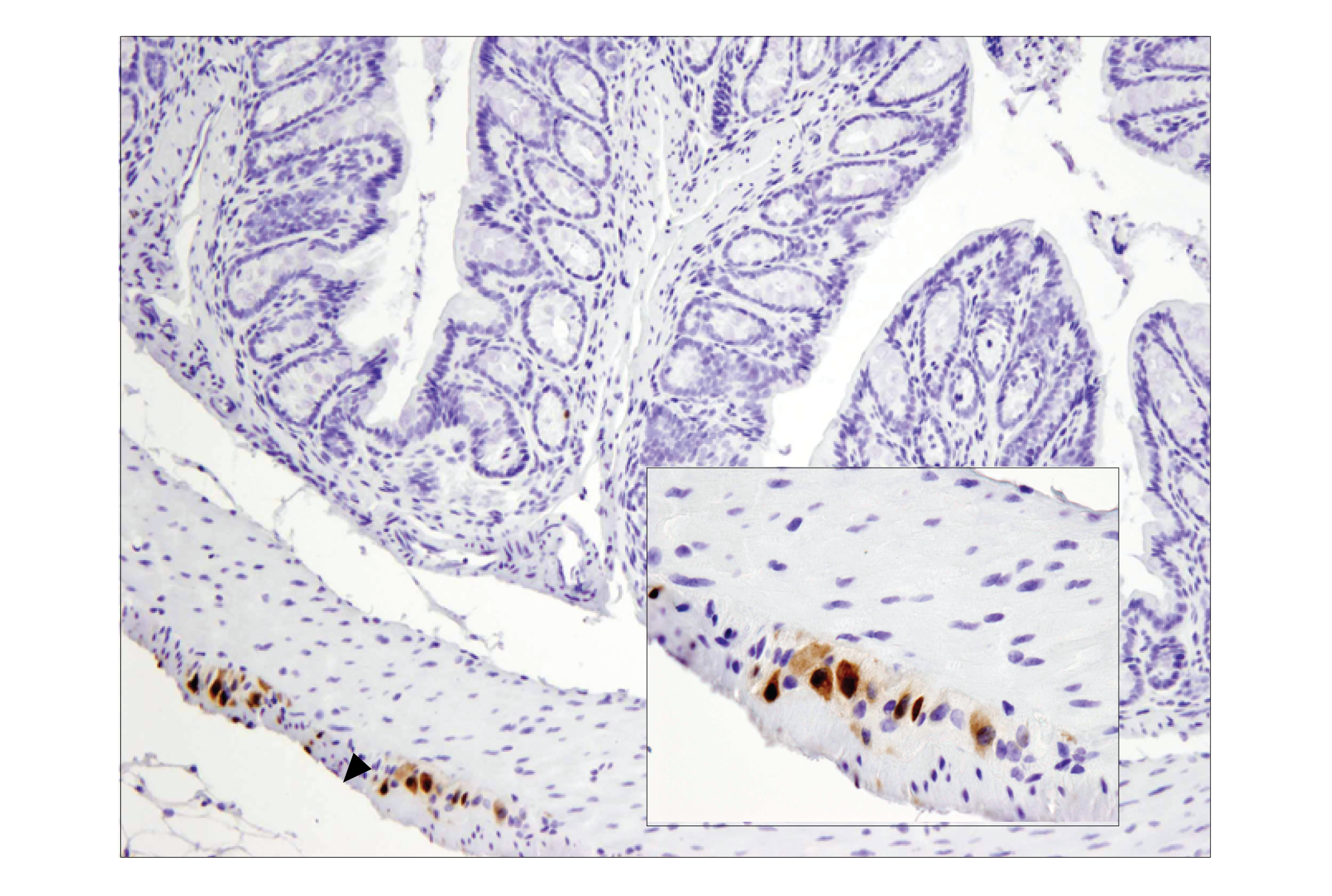  Image 31: Mature Neuron Marker Antibody Sampler Kit