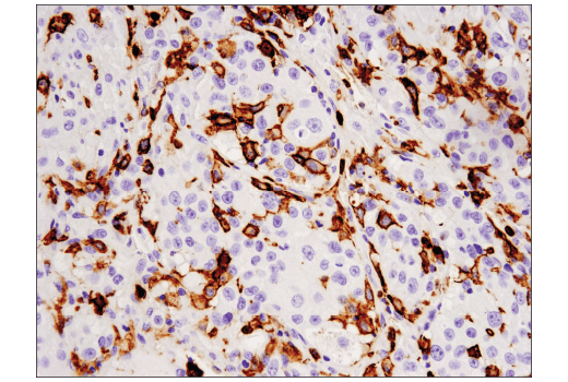 Immunohistochemistry Image 3: CD16 (D1N9L) Rabbit mAb