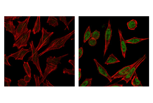 Immunofluorescence Image 1: Phospho-ATF-2 (Thr71)/ATF-7 (Thr53) Antibody