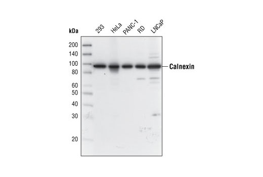 Western Blotting Image 1: Calnexin Antibody