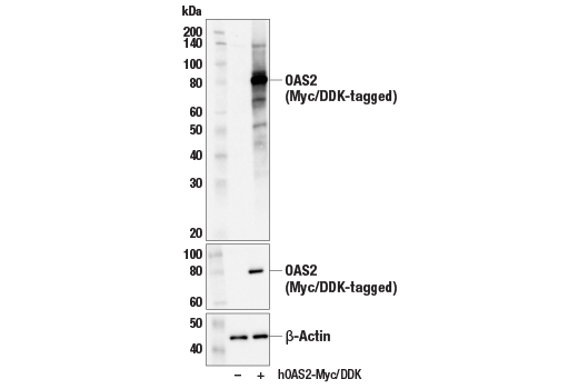  Image 11: OAS/RNase L Pathway Antibody Sampler Kit