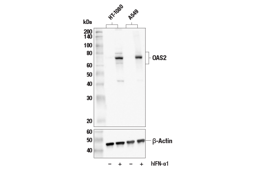  Image 4: OAS/RNase L Pathway Antibody Sampler Kit