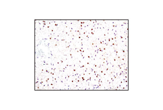  Image 3: Huntingtin Interaction Antibody Sampler Kit