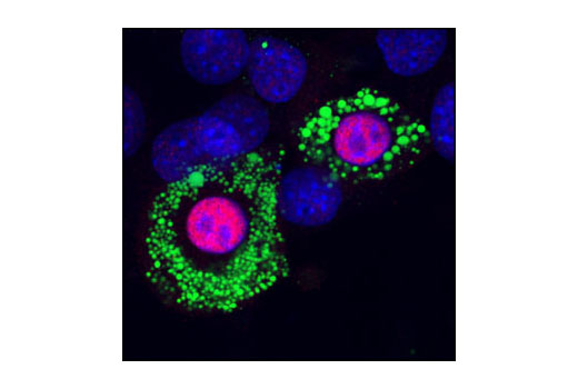  Image 4: Adipogenesis Marker Antibody Sampler Kit