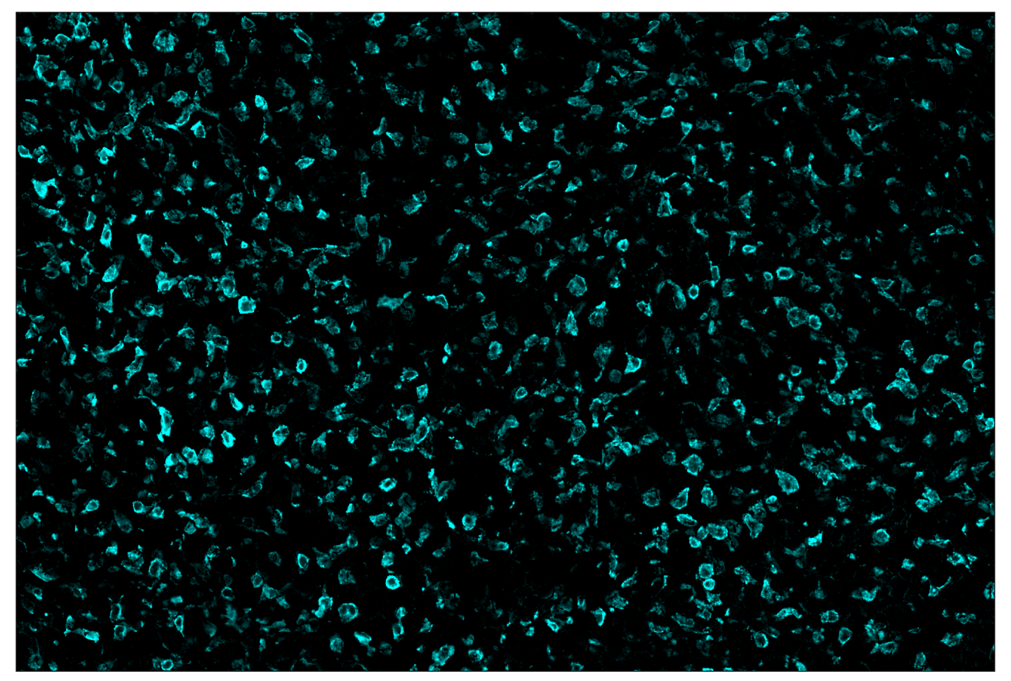 Immunohistochemistry Image 5: CD206/MRC1 (E6T5J) & CO-0032-750 SignalStar™ Oligo-Antibody Pair