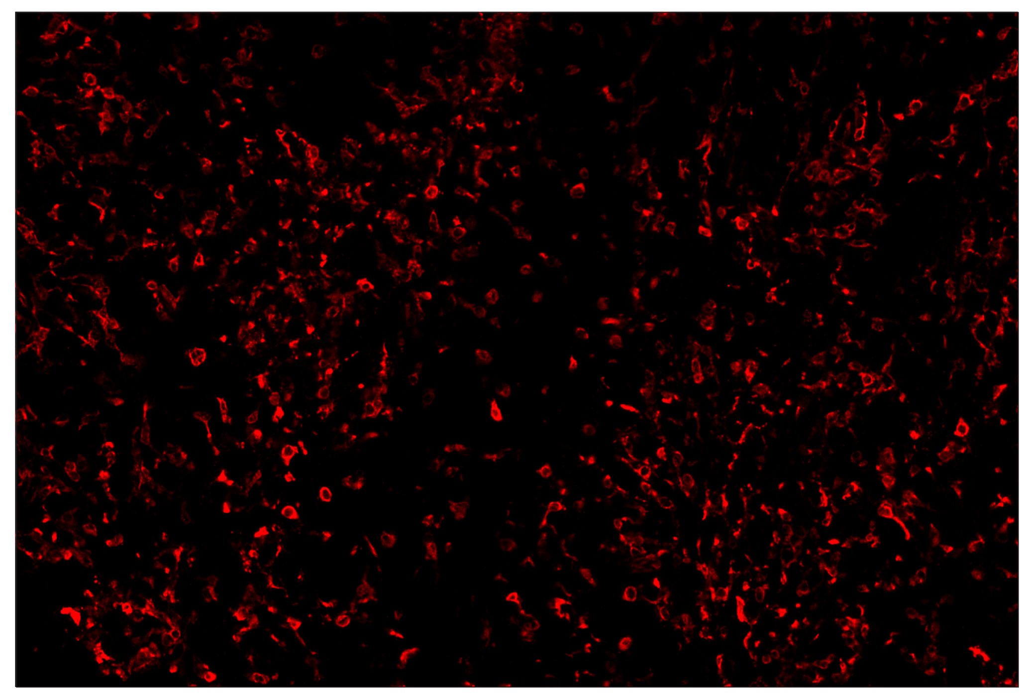 Immunohistochemistry Image 4: CD206/MRC1 (E6T5J) & CO-0032-594 SignalStar™ Oligo-Antibody Pair